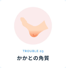 かかとの角質